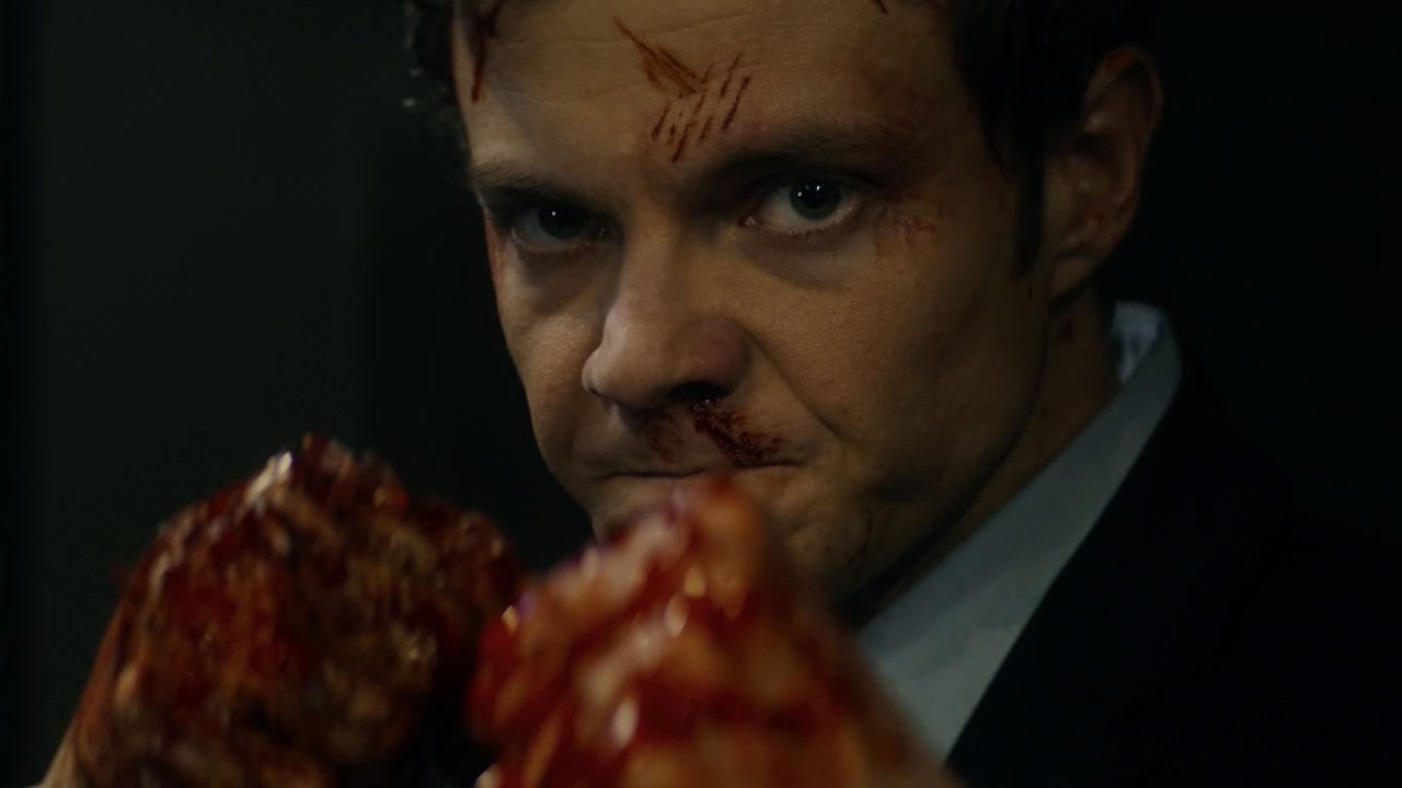 Novocaine Movie Screenshot 5